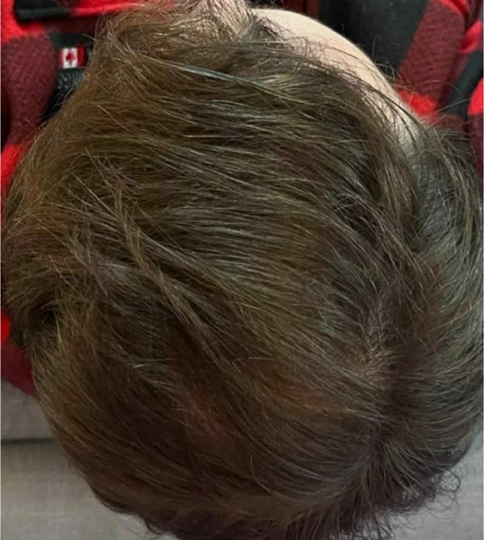 Eftir: hvirfilsvæði með auknum þéttleika